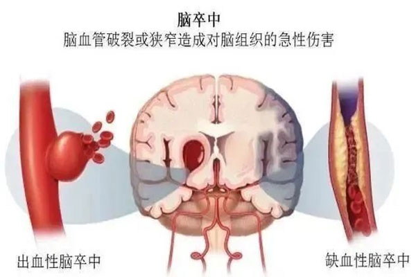 �з�,ȱѪ���з�,��Ѫ���з�