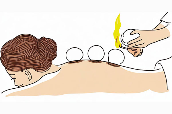 ��ҽ�ι�,�ι�����,�ι���ȷ����,��Ӯ����